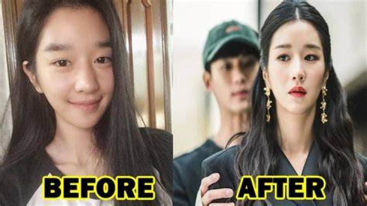 Seo Ye Ji Plastic Surgery, Before After Pics Age Wiki
